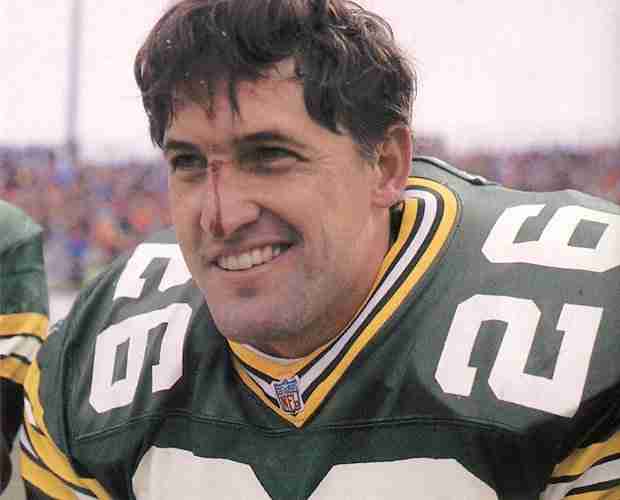 Chuck Cecil With A Bloody Nose Playing For Packers